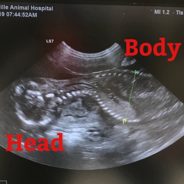 Abdominal Ultrasound