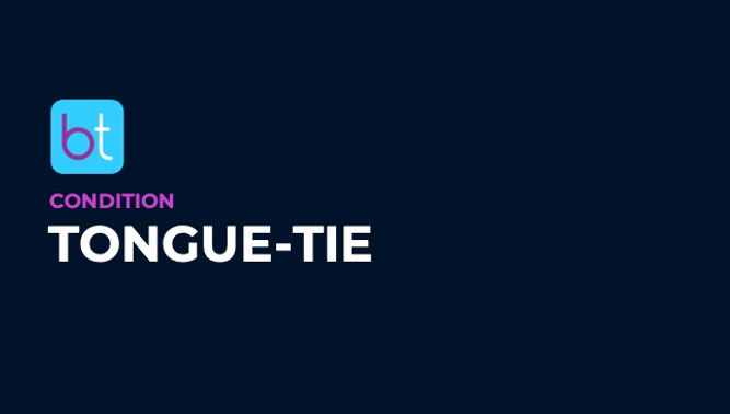 Tongue-Tie Condition Overview
