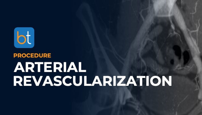 Arterial Revascularization Procedure Prep