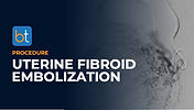 Uterine Fibroid Embolization