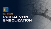 Portal Vein Embolization
