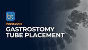 Gastrostomy Tube Placement