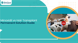 Minoxidil vs hair transplant comparison showing topical application and surgical hair restoration procedure for permanent hair loss solution guide