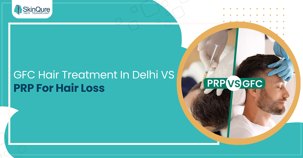 GFC Hair Treatment in Delhi vs PRP for hair loss comparison showing PRP injection on scalp and GFC treatment on a male patient, with SkinQure branding.