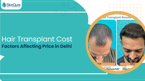 Hair Transplant Cost: Factors Affecting Price in Delhi