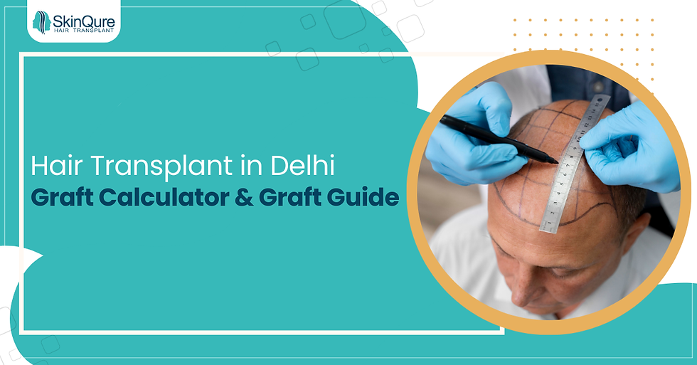 Hair Transplant in Delhi – Doctor marking bald scalp with ruler and pen for graft calculator & graft guide.