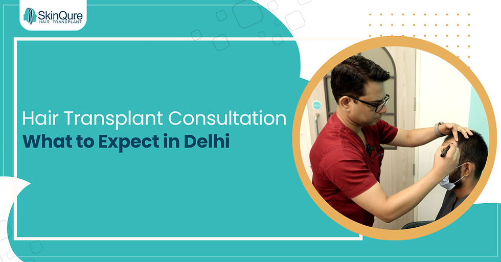 Hair transplant consultation at SkinQure Clinic in Delhi — a specialist examines a patient’s scalp during a pre-surgery evaluation to determine the best hair restoration plan.