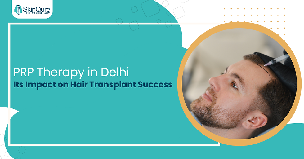 PRP Therapy in Delhi and Its Impact on Hair Transplant Success