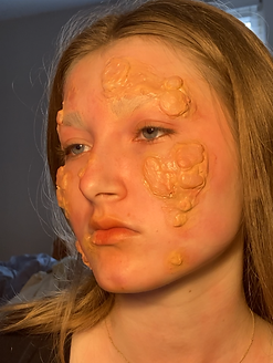 Blisters (4).PNG