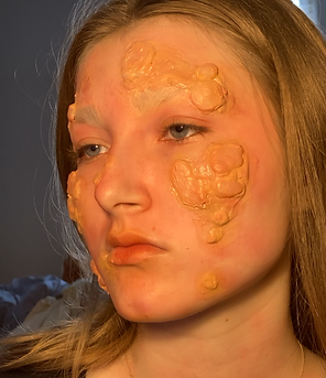 Blisters (4).PNG