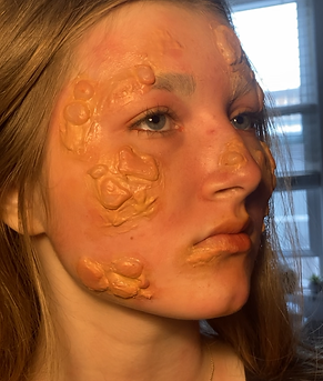 Blisters (8).PNG