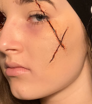 lost eye and cut (1).PNG