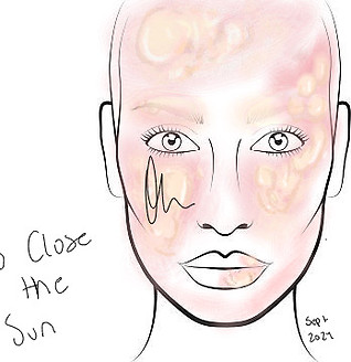 Blisters Drawing.JPG