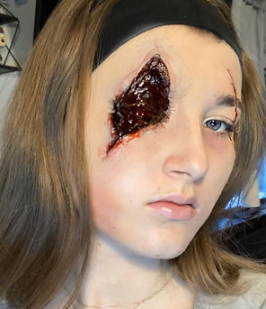 lost eye and cut (3).JPG