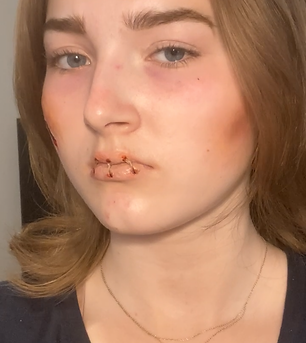 Sewn Shut (3).PNG
