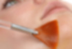 Skin Confidence Pro Resurfacer Facial Treatment Trowbridge.jpeg