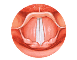 cordes vocales phonation.png