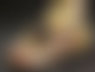 EROSIONE SILENZIOSA! Piede Diabetico: Quando lo zucchero distrugge le tue fondamenta