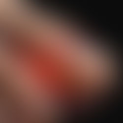 QUEL BATTITO CHE NON TI FA DORMIRE! ☝️💥 Unghie e infezioni: cosa sta succedendo davvero sotto la tua pelle?