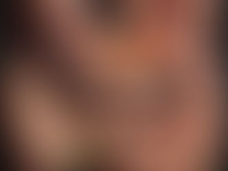 Malattia di Crohn: Infiammazione cronica della parete intestinale 🌶️ 🔥