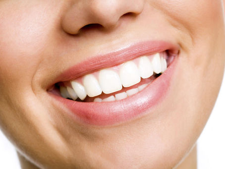 Teeth Whitening: Brighten Your Smile with Confidence
