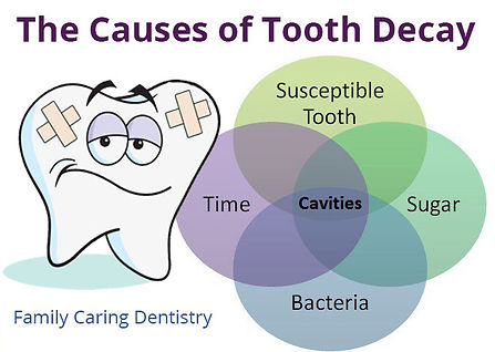 Cause of tooth decay