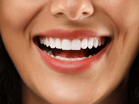 Porcelain Veneers: The Secret to a Perfect Smile