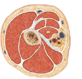 sarcopenia.gif