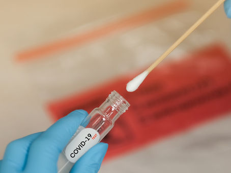 Mais centros de testagem rápida para covid-19 são abertos em Belém