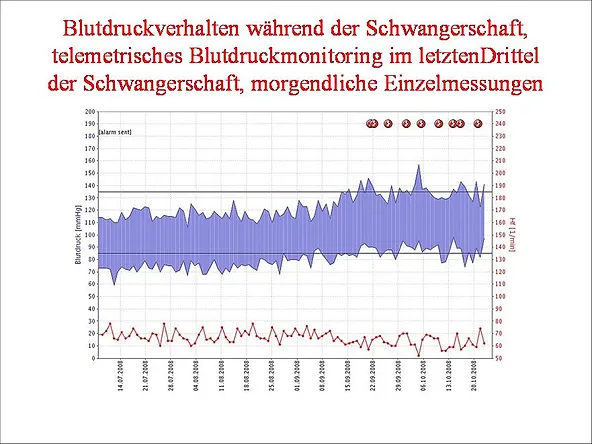 Blutdruck Telemonitoring Hypertoniezentrum