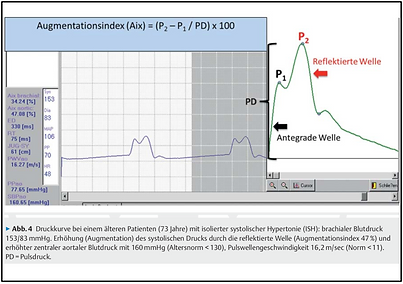 Pulswellenanalyse Projekte.png