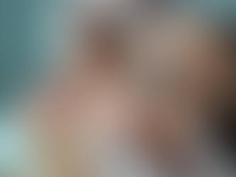 Botox for Forehead Wrinkles: Your Guide to a Smoother, Younger-Looking Forehead