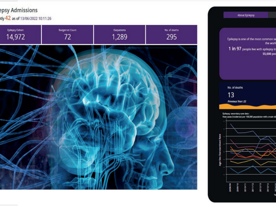 Working towards a Scottish Epilepsy Register