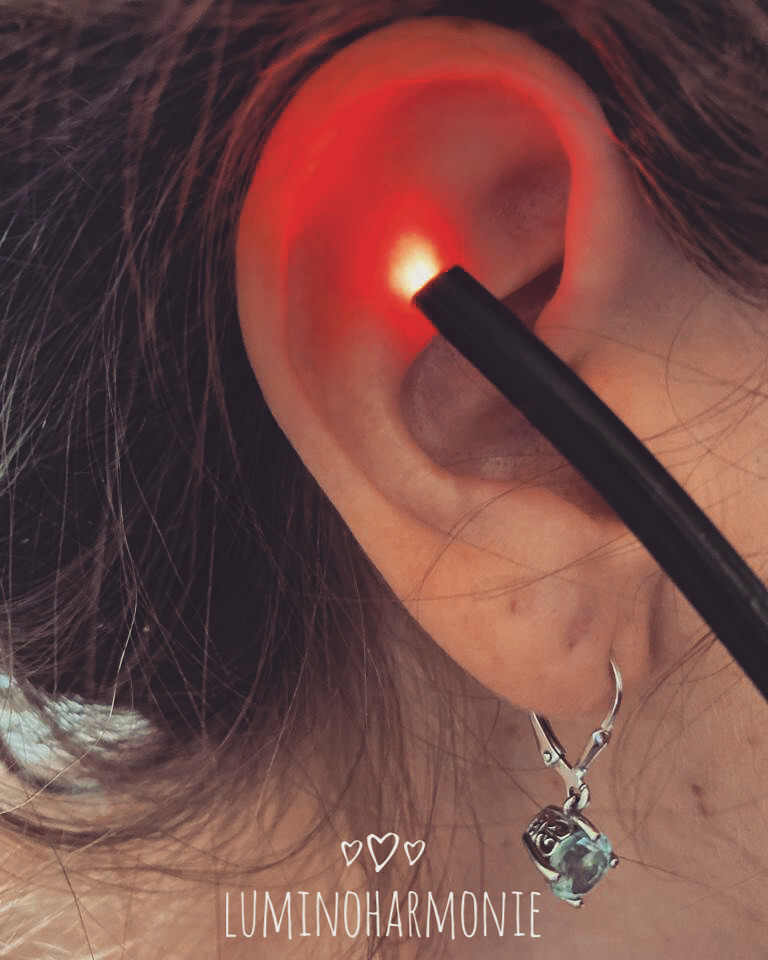 C’est une technique permettant de stimuler les points réflexes du pavillon de l’oreille par les ondes de lumière colorée. Son origine vient de l’acupuncture auriculaire chinoise. Le pavillon auriculaire est étroitement lié au cerveau, lequel gère les organes du corps. La zone pavillonnaire emprunte des voies réflexes par l'intermédiaire du système nerveux cérébro-spinal et du système nerveux végétatif. Cette technique est particulièrement efficace pour traiter des douleurs telles que l’arthrose, le lumbago, la névralgie, la sciatique, la cervicalgie, les migraines ainsi que les douleurs aux épaules et aux genoux. Elle entraîne la libération d’endorphines, qui sont des hormones ayant la faculté d’augmenter la résistance à la douleur. Elle permet également de réduire le stress, l’anxiété et les troubles du sommeil. Finalement, elle est indiquée pour les dépressions passagères et les addictions (tabac, l’alcool…)
