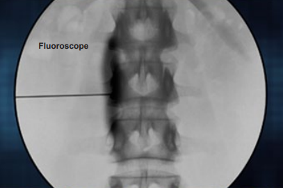fluoroscope