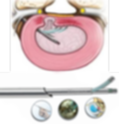 endoscopic