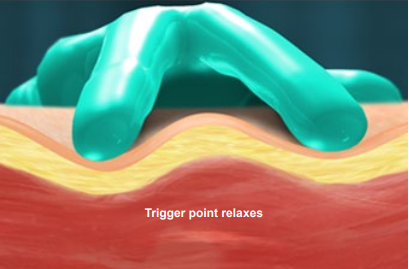 trigger point relaxes