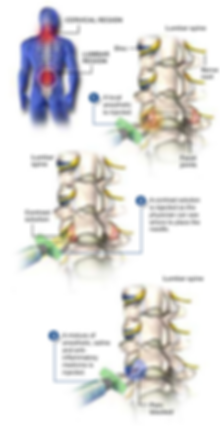 lumbar spine