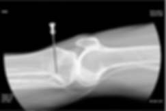xray injection