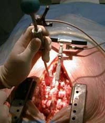 surgery
