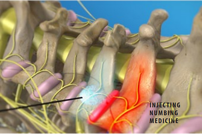 injecting numbig medicine