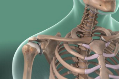 labrum tear
