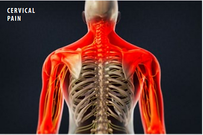 cervical pain