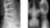 screws