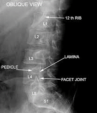 NorTex Spine & Joint Institute | Chiropractic & Pain Case ...