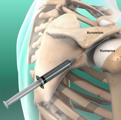 acromion, humerus