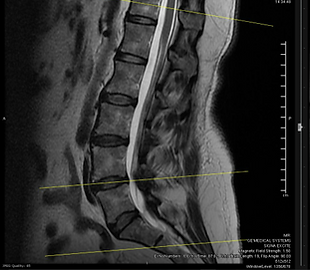 xray