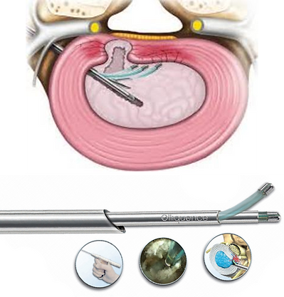 endoscpic