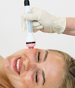 Anti-Aging-Abigon-Pro-Facial-at-Skinfinity-Esthetics
