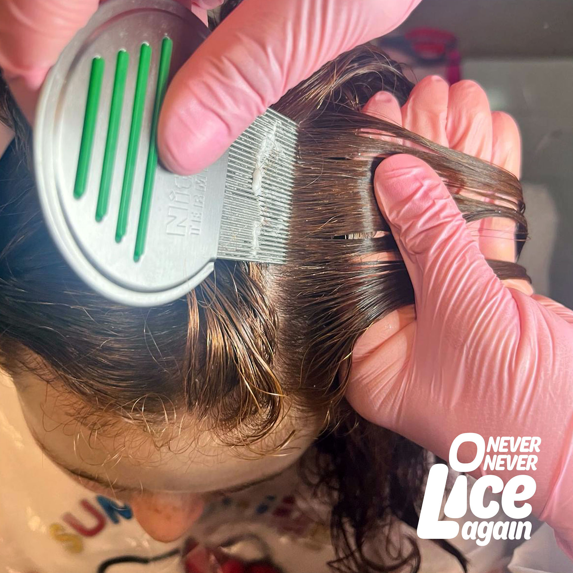 Lice & Nits Treatment and Removal in Washington DC